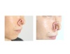 Zazhim_Turbo_Technical_Nose_Clip_2